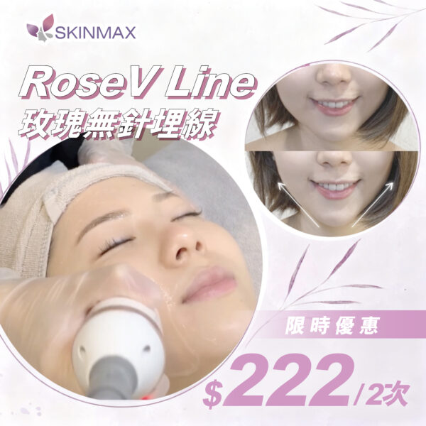 新客戶優惠 | Rose V Line 無針無痛提拉 HIFU玫瑰線